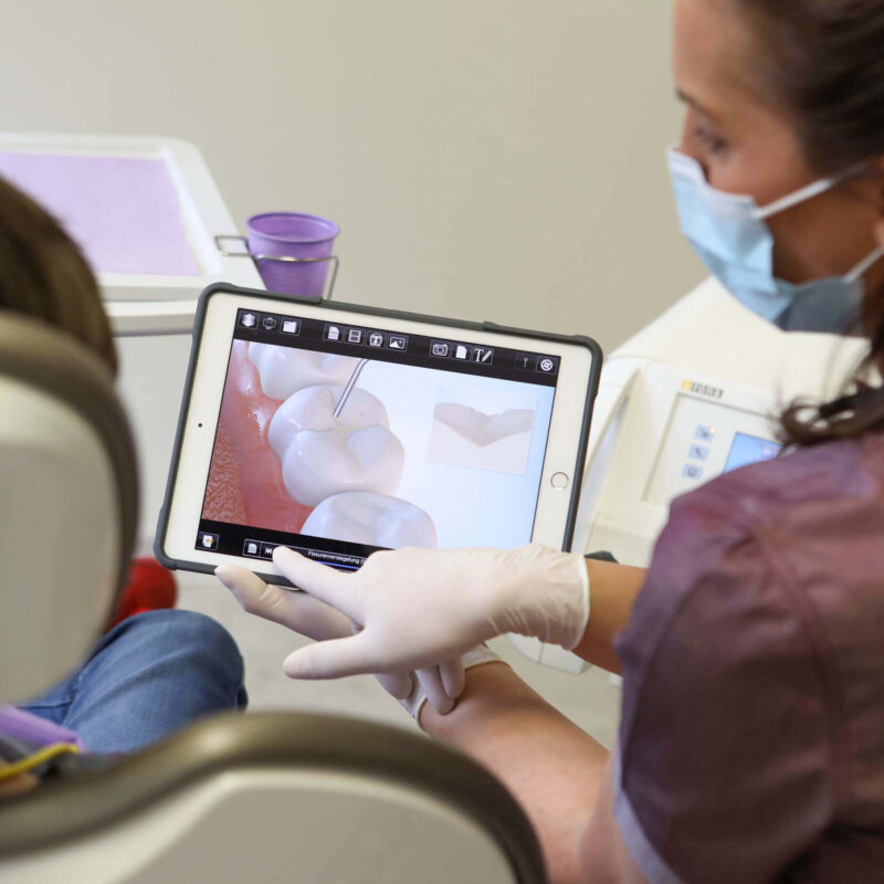 Zahnaerzte_am_Augustaplatz_Fissurenversiegelung_Kachel