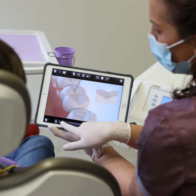 Zahnaerzte_am_Augustaplatz_Fissurenversiegelung_Kachel