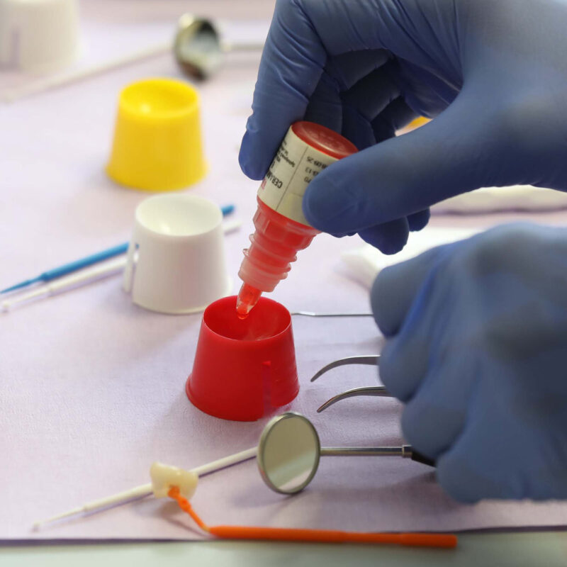 Zahnaerzte_am_Augustaplatz_Keramikinlays_Kachel