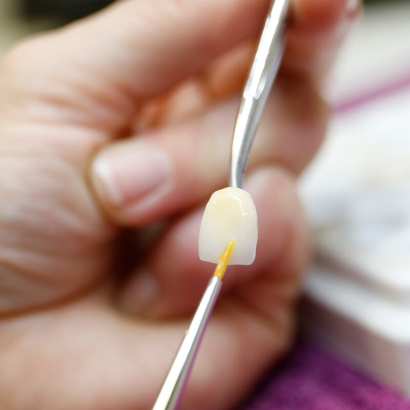 Zahnaerzte_am_Augustaplatz_Veeners_Kachel