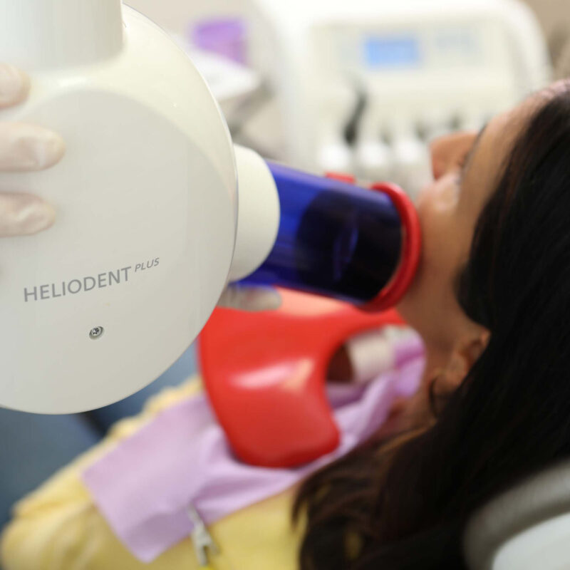 Zahnaerzte_am_Augustaplatz_Wurzelbehandlung_Endodontie_Kachel