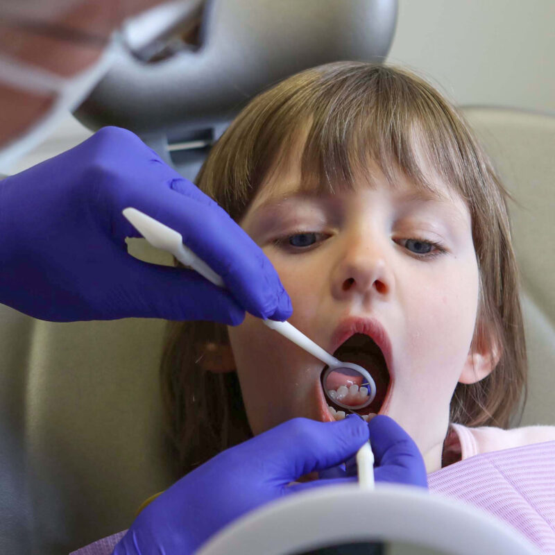 Zahnaerzte_am_Augustaplatz_Zahnsanierung_Kachel