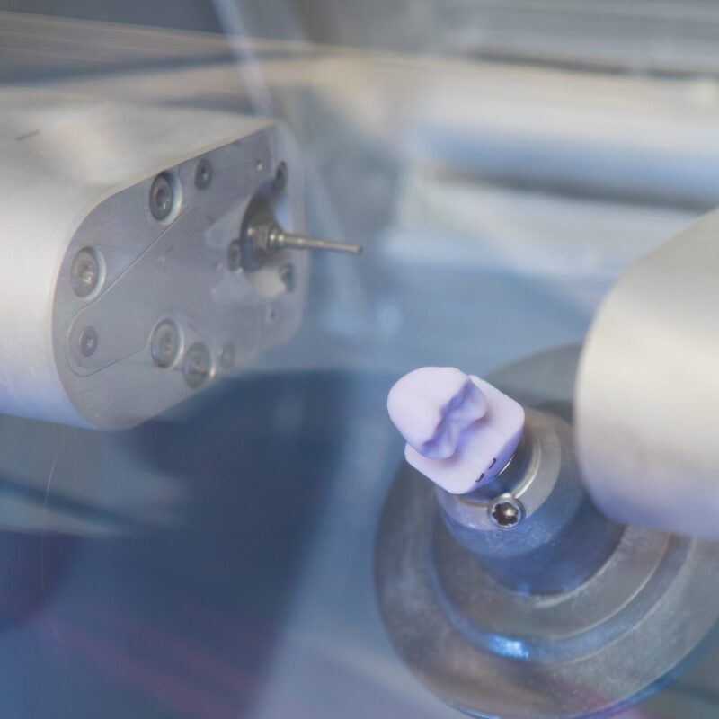 Zahnaerzte_am_Augustaplatz_CEREC_Kachel